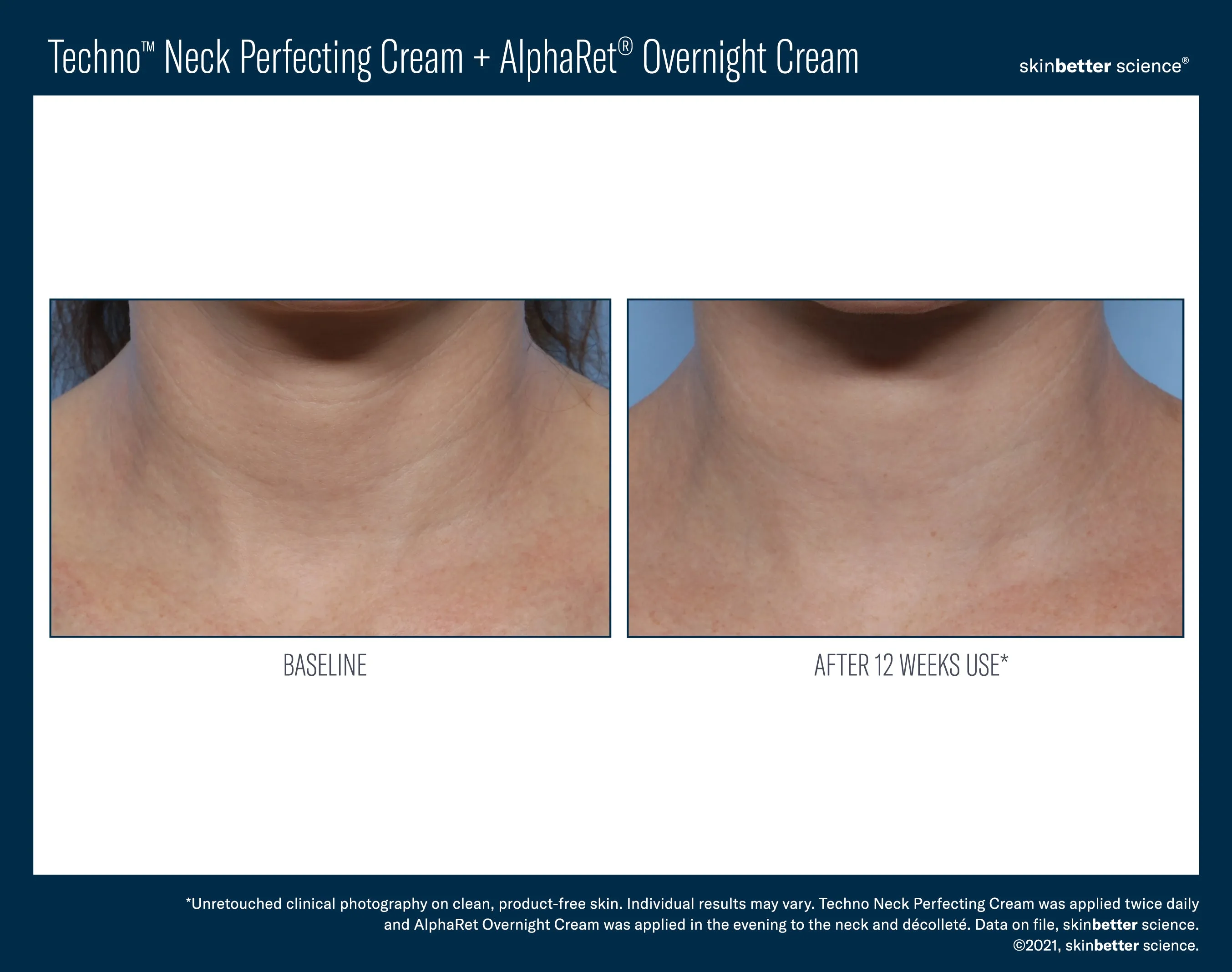 Skinbetter Science Techno Neck Perfecting Cream