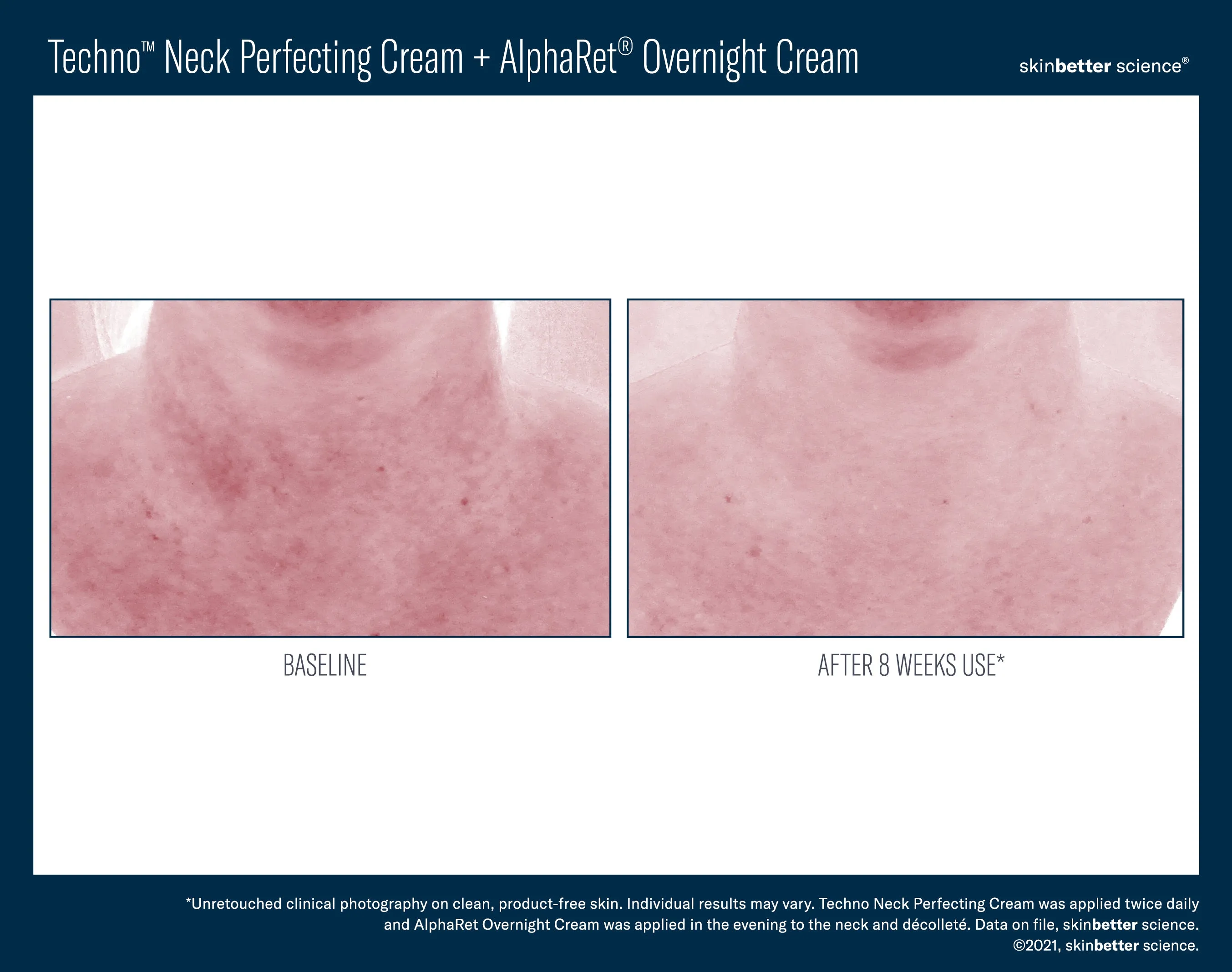 Skinbetter Science Techno Neck Perfecting Cream